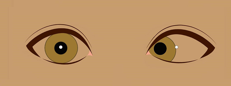 Eyes