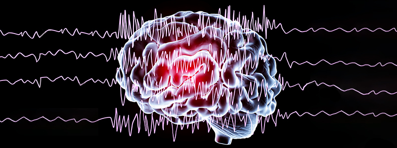 eeg scan with brain picture