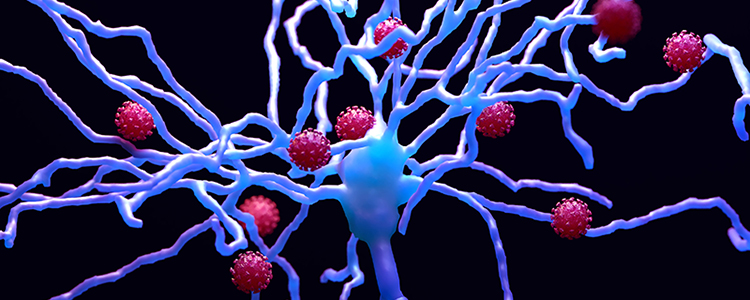 Covid 19 deteriorating myelin of the neuron