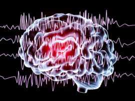 eeg with picture of brain