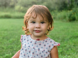 Infant Girl outdoors with hemangioma