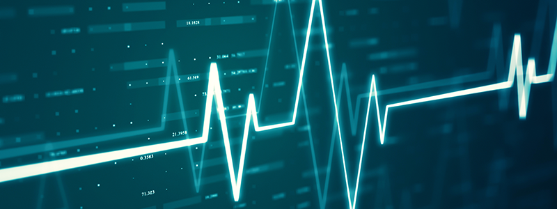 blue ekg screen