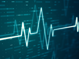 Blue ekg screen