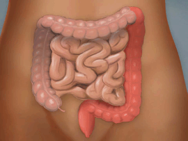 Inflammatory Bowel Disease (IBD) (10 min.)