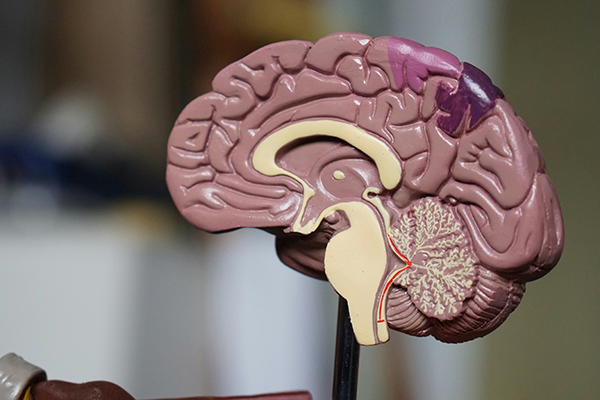 Functional (Psychogenic Non-Epileptic) Seizures (21 min.)